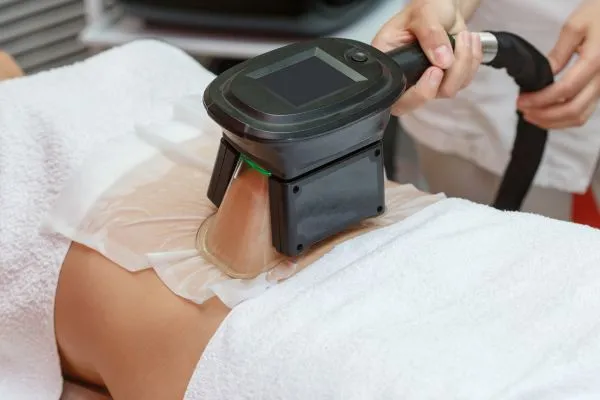 Image of person having fat freezing treatment to help weight gain Heath