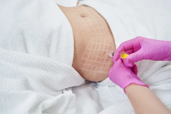 image of fat dissolving injections on love handles to help combat weight gain Heath