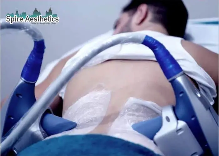 Man having fat freezing treatment done on love handles before a competitions Heath to create a sculpted look.